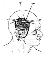 Nerve Theory